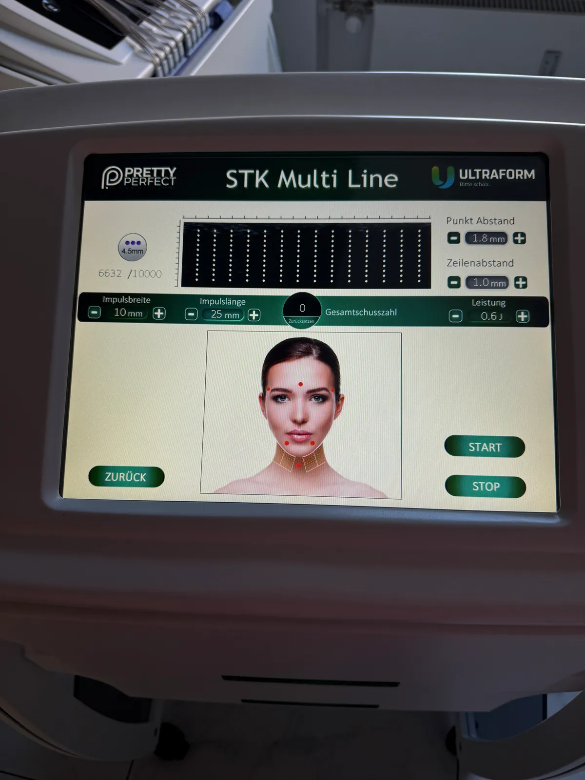 Ultherapie / HIFU