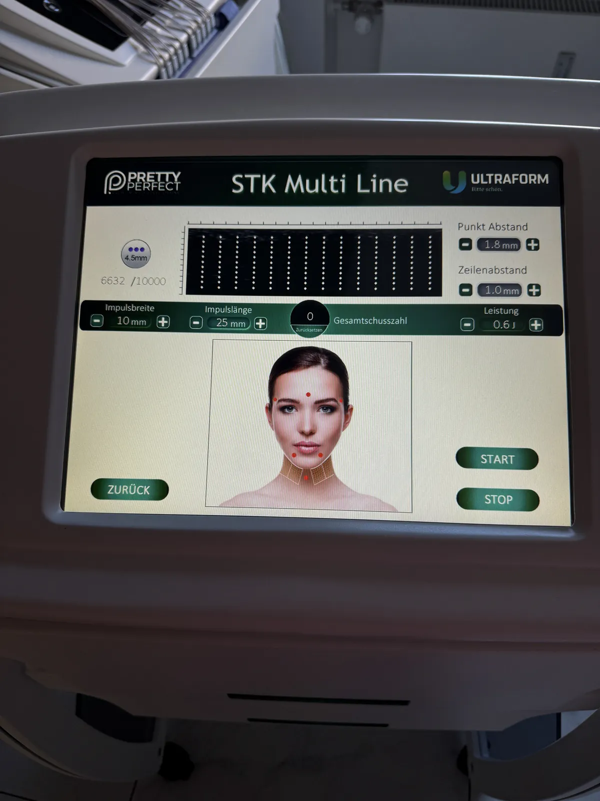 STK Multi Line Ultraform für Ultherapie HIFU bei Ana Wimmer München